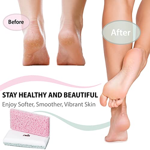 Glass Pumice Stone Callus Remover for Feet, Elbows, Hands, and Knees, Spain Made - 2 in 1 Pedicure Exfoliator and Scrubber for Rough, Hard Skin (Teal Color) - style: Teal - 2 Count ( Pack of 1)