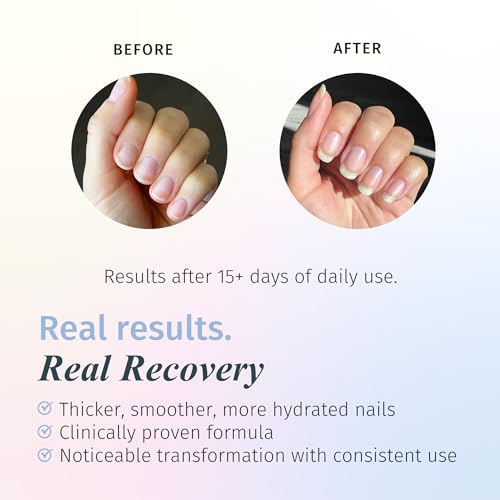 Duri Rejuvacote 1 Nail Growth System + 154N Bewitched Neon Orange Matte Nail Polish Bundle - Nail Strengthener & Bold Matte Color Duo, Statement Neon Manicure Set, 0.45 Fl Oz Each - color: Bewitched + Rejuvacote 1 (Pack of 2)