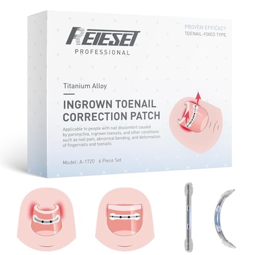 Titanium Alloy Ingrown Toenail Treatment, Nail Tools, and Ingrown Toenail Removal Kit Specially Designed for Curved Nail Repair and Ingrown Toenail Corrector (0.59/0.67in) - size: 0.59/0.67in