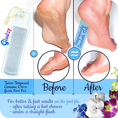 GLADZY Genuine Czech Glass Nail File Set - Callus Remover Foot Rasp, Cuticle Pusher Manicure Stick, Double Sided Etched Different Grit Surface, Professional Nail Care Tool, Made in EU - color: All-in-one Set - Lemon Green