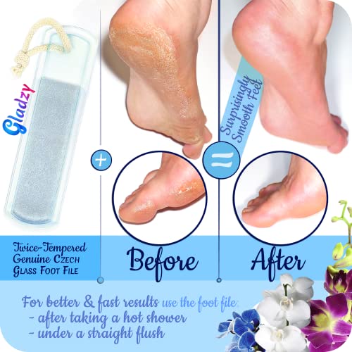 Genuine Czech Glass Nail File Set by GLADZY - Callus Remover Foot Rasp, Cuticle Pusher Manicure Stick, Double Sided Etched Different Grit Surface, Professional Nail Care Tool Kit, Made in EU - color: All-in-one Set