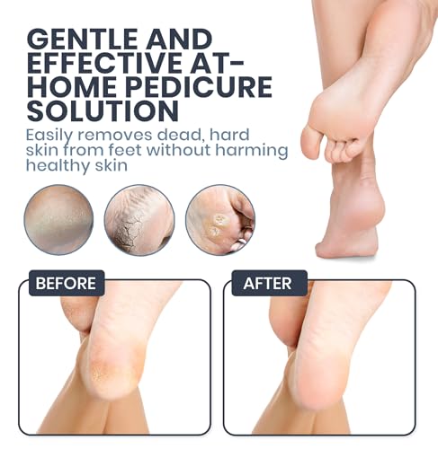 Upgraded 2026 Electric Foot File – Callus Remover for Women & Men with Adjustable Speed, 60 Sanding Pads & Dead Skin Exfoliation – at-Home Pedicure Tool for Dry, Cracked Feet (Pink)