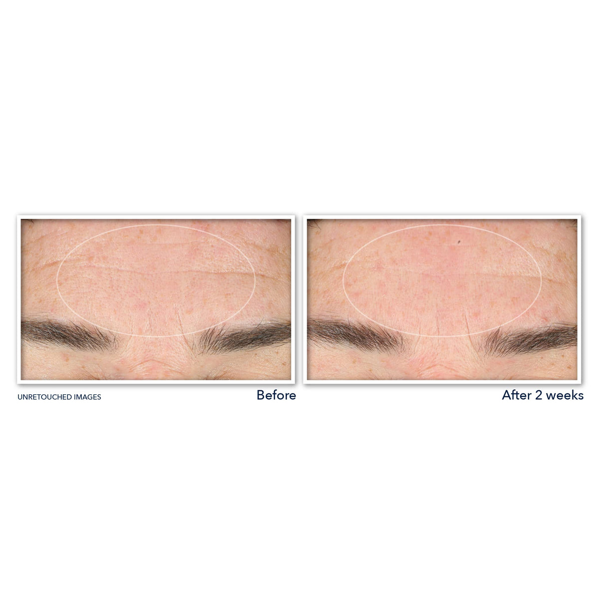 RoC Derm Correxion Serum Facial Cleanser with Niacinamide and Amino Acids