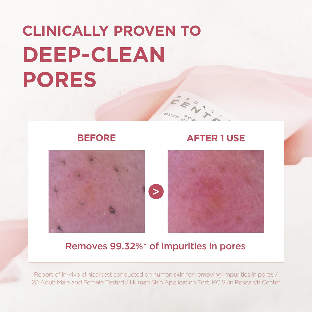 SKIN1004 [Hudson's Pick Poremizing Deep Cleansing Foam, Makeup Remover, Korean Face Cleanser with Himalayan Pink Salt & Centella for Facial Pore Cleansing, Korean Skin Care, 4.23 fl.oz, 125ml