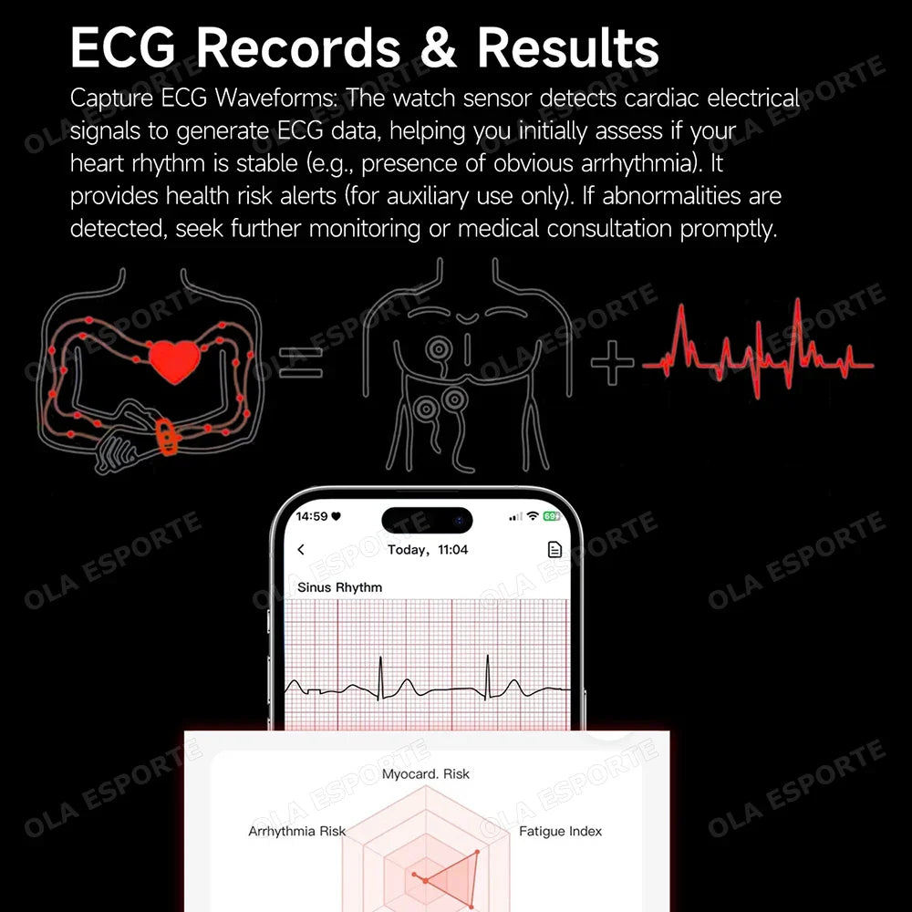 2026 NO Screen Smart Bracelet ECG+PPG SOS Heart Rate Blood Pressure Stress Temperature Sports Waterproof Screenless Smartwatch