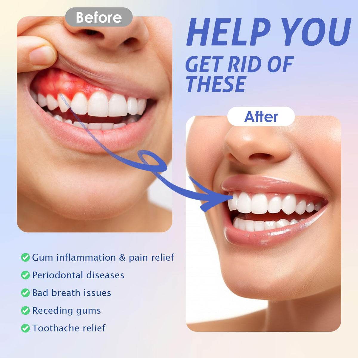 Red Light Therapy for Gums, Red & Blue LED Light Experience with 18 LEDs, Comfortable Silicone Mouthpiece, Portable Personal Oral Care for Gum Health Toothache Relief, Bleeding Gums